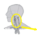 頚動脈図